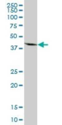 Western Blot: MRPS27 Antibody [H00023107-B01P] - Analysis of MRPS27 expression in human kidney.