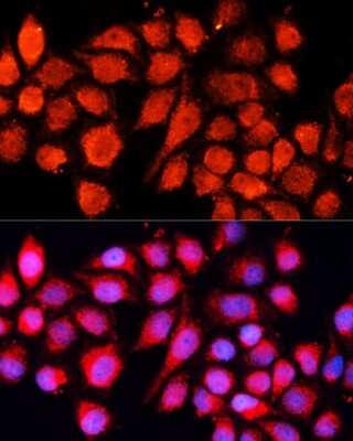 Immunocytochemistry/Immunofluorescence: MRPS28 Antibody [NBP2-93219] - Analysis of HeLa cells using MRPS28 . Blue: DAPI for nuclear staining.