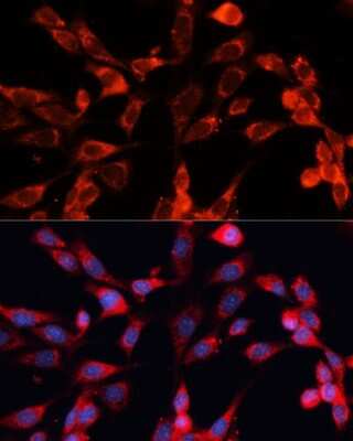 Immunocytochemistry/Immunofluorescence: MRPS28 Antibody [NBP2-93219] - Analysis of NIH-3T3 cells using MRPS28 . Blue: DAPI for nuclear staining.