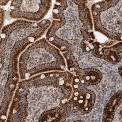 Immunohistochemistry-Paraffin MRPS28 Antibody