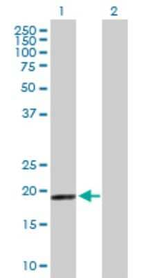 Western Blot MRPS28 Antibody