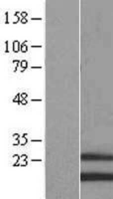 Western Blot: MRPS28 Overexpression Lysate (Adult Normal) [NBL1-13299] - Western Blot experiments.  Left-Control; Right -Over-expression Lysate for MRPS28.