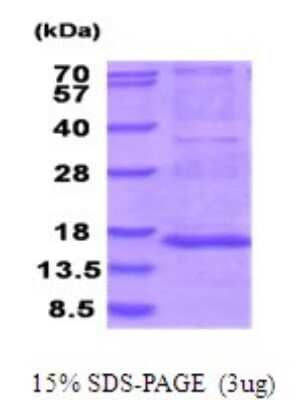 SDS-PAGE Recombinant Human MRPS28 His Protein