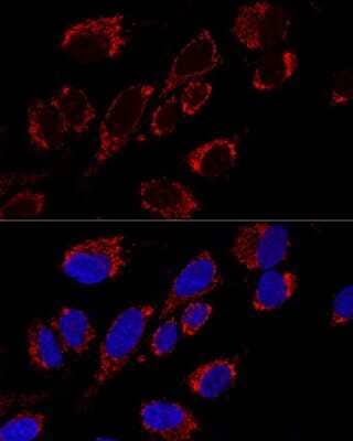Immunocytochemistry/ Immunofluorescence MRPS31 Antibody - Azide and BSA Free
