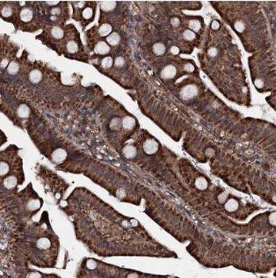 Immunohistochemistry MRPS31 Antibody - BSA Free