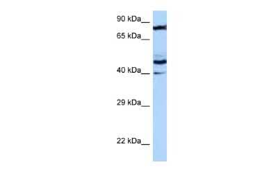 Western Blot: MRPS31 Antibody [NBP2-87838] - WB Suggested Anti-MRPS31 Antibody. Titration: 1.0 ug/ml. Positive Control: HT1080 Whole CellMRPS31 is strongly supported by BioGPS gene expression data to be expressed in Human HT1080 cells