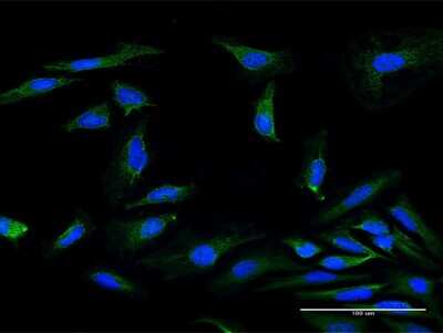 Immunocytochemistry/Immunofluorescence: MRPS34 Antibody [H00065993-B01P] - Analysis of purified antibody to MRPS34 on HeLa cell. (antibody concentration 10 ug/ml)