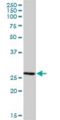Western Blot: MRPS34 Antibody [H00065993-B01P] - Analysis of MRPS34 expression in human placenta.