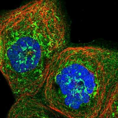 Immunocytochemistry/Immunofluorescence: MRPS35 Antibody [NBP1-82786] - Staining of human cell line A-431 shows localization to cytosol & mitochondria.
