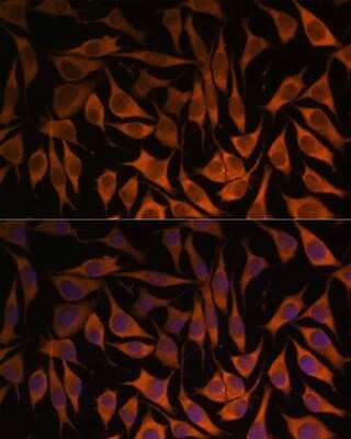 Immunocytochemistry/Immunofluorescence: MRPS35 Antibody [NBP2-94003] - Analysis of L929 cells using MRPS35 at dilution of 1:100. Blue: DAPI for nuclear staining.