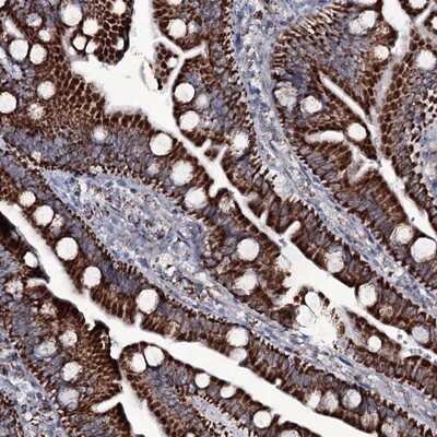 Immunohistochemistry-Paraffin: MRPS35 Antibody [NBP1-82786] - Staining of human small intestine shows strong cytoplasmic positivity in glandular cells.