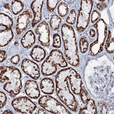 Immunohistochemistry-Paraffin MRPS35 Antibody