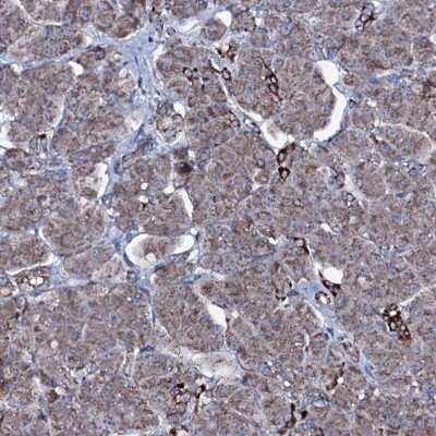 Immunohistochemistry-Paraffin MRPS35 Antibody