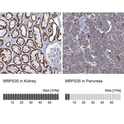 Immunohistochemistry-Paraffin MRPS35 Antibody