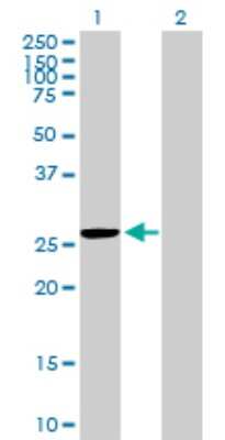 Western Blot: MRPS35 Antibody [H00060488-B01P] - Analysis of MRPS35 expression in transfected 293T cell line by MRPS35 polyclonal antibody.  Lane 1: MRPS35 transfected lysate(25.08 KDa). Lane 2: Non-transfected lysate.