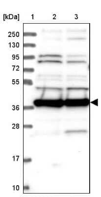 Western Blot: MRPS35 Antibody [NBP1-82786] - Lane 1: Marker  [kDa] 250, 130, 95, 72, 55, 36, 28, 17, 10.  Lane 2: Human cell line RT-4.  Lane 3: Human cell line U-251MG sp