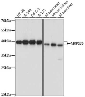 Western Blot: MRPS35 Antibody [NBP2-94003] - Analysis of extracts of various cell lines, using MRPS35 at 1:1000 dilution.Secondary antibody: HRP Goat Anti-Rabbit IgG (H+L) at 1:10000 dilution.Lysates/proteins: 25ug per lane.Blocking buffer: 3% nonfat dry milk in TBST.Detection: ECL Basic Kit .Exposure time: 5s.
