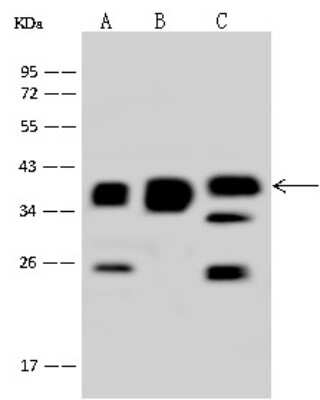 Western Blot: MRPS35 Antibody [NBP2-98524] - Anti-MRPS35 rabbit polyclonal antibody at 1:500 dilution. Lane A: Hela Whole Cell Lysate Lane B: A549 Whole Cell Lysate Lane C: Jurkat Whole Cell Lysate Lysates/proteins at 30 ug per lane. Secondary Goat Anti-Rabbit IgG (H+L)/HRP at 1/10000 dilution. Developed using the ECL technique. Performed under reducing conditions. Predicted band size: 37 kDa. Observed band size: 37 kDa