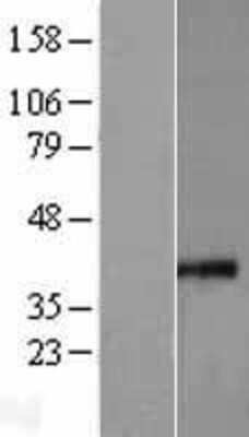 Western Blot: MRPS35 Overexpression Lysate (Adult Normal) [NBL1-13304] Left-Empty vector transfected control cell lysate (HEK293 cell lysate); Right -Over-expression Lysate for MRPS35.