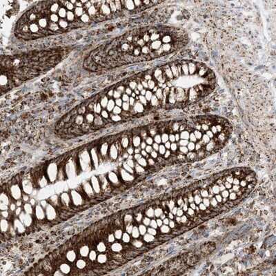 Immunohistochemistry-Paraffin MRPS36 Antibody