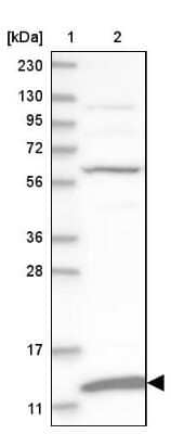 Western Blot MRPS36 Antibody