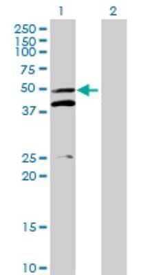 Western Blot: MRPS5 Antibody [H00064969-B01P] - Analysis of MRPS5 expression in transfected 293T cell line by MRPS5 polyclonal antibody.  Lane 1: MRPS5 transfected lysate(47.3 KDa). Lane 2: Non-transfected lysate.