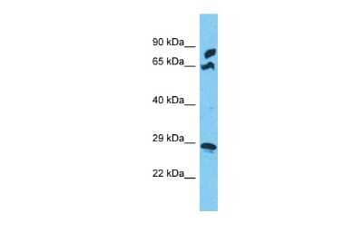 Western Blot: MRPS5 Antibody [NBP2-85328] - Host: Rabbit. Target Name: MRPS5. Sample Type: COLO205 Whole Cell lysates. Antibody Dilution: 1.0ug/ml