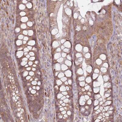 Immunohistochemistry-Paraffin: MRPS6 Antibody [NBP2-30496] - Staining of human rectum shows moderate cytoplasmic positivity in glandular cells.