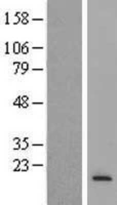 Western Blot: MRPS6 Overexpression Lysate (Adult Normal) [NBL1-13307] Left-Empty vector transfected control cell lysate (HEK293 cell lysate); Right -Over-expression Lysate for MRPS6.