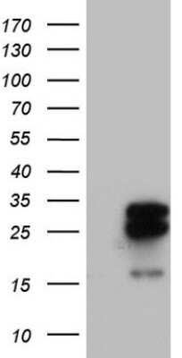 Western Blot: MRPS7 Antibody (5E11) [NBP2-45433] - Analysis of HEK293T cells were transfected with the pCMV6-ENTRY control (Left lane) or pCMV6-ENTRY MRPS7.