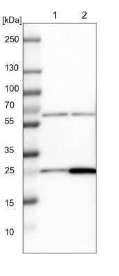 Western Blot: MRPS7 Antibody [NBP1-81029] - Lane 1: NIH-3T3 cell lysate (Mouse embryonic fibroblast cells). Lane 2: NBT-II cell lysate (Rat Wistar bladder tumor cells).