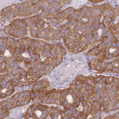 Immunohistochemistry-Paraffin: MRPS9 Antibody [NBP2-30429] - Staining of human parathyroid gland shows high expression.