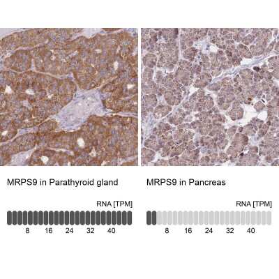 Immunohistochemistry-Paraffin: MRPS9 Antibody [NBP2-30429] - Staining in human parathyroid gland and pancreas tissues using anti-MRPS9 antibody. Corresponding MRPS9 RNA-seq data are presented for the same tissues.