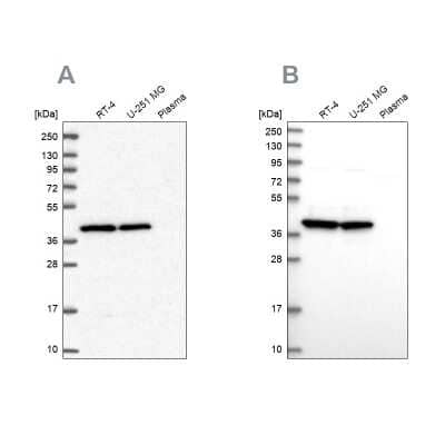 Western Blot: MRPS9 Antibody [NBP2-30429] - Analysis using Anti-MRPS9 antibody NBP2-30429 (A) shows similar pattern to independent antibody NBP2-30501 (B).