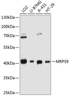 Western Blot: MRPS9 Antibody [NBP2-93709] - Analysis of extracts of various cell lines, using MRPS9 at 1:3000 dilution.Secondary antibody: HRP Goat Anti-Rabbit IgG (H+L) at 1:10000 dilution.Lysates/proteins: 25ug per lane.Blocking buffer: 3% nonfat dry milk in TBST.Detection: ECL Basic Kit .Exposure time: 1s.