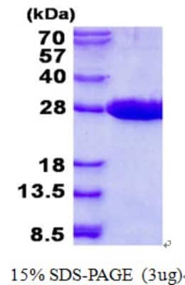 SDS-Page: MRRF Protein [NBP2-23244]
