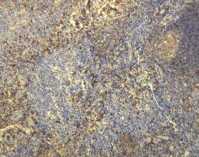 Immunohistochemistry-Paraffin: MS4A1/CD20 Antibody (E17-P) [NBP1-30144] - CD20 expression in b-lymphocytes of the palatine tonsil. Formalin fixed, paraffin embedded human tissues (4 um sections) stained with anti- CD20 monospecific clonal antibody