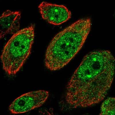 Immunocytochemistry/Immunofluorescence: MSANTD2 Antibody [NBP1-93931] - Staining of human cell line PC-3 shows positivity in nucleus but excluded from the nucleoli. Antibody staining is shown in green.