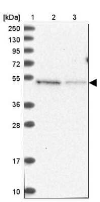 Western Blot: MSANTD2 Antibody [NBP1-93931] - Lane 1: Marker [kDa] 250, 130, 95, 72, 55, 36, 28, 17, 10Lane 2: Human cell line RT-4Lane 3: Human cell line U-251MG sp