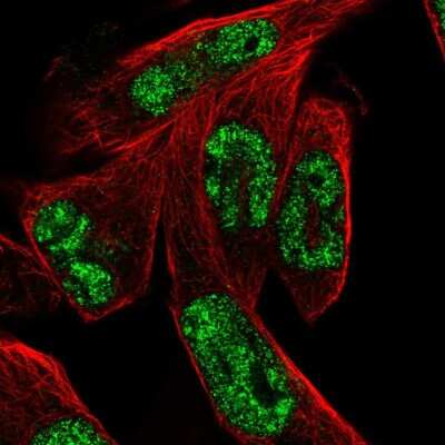 Immunocytochemistry/Immunofluorescence: MSANTD3 Antibody [NBP2-57629] - Staining of human cell line RH-30 shows localization to nucleoplasm.