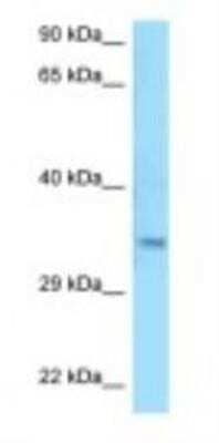 Western Blot: MSANTD3 Antibody [NBP1-98441] - HepG2 Cell Lysate 1.0ug/ml, Gel Concentration: 12%