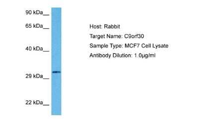 Western Blot: MSANTD3 Antibody [NBP2-87846] - Host: Rabbit. Target Name: C9ORF30. Sample Tissue: Human MCF7 Whole Cell lysates. Antibody Dilution: 1ug/ml