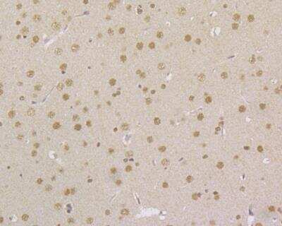 Immunohistochemistry: MSH2 Antibody (10G1) [NBP2-76895] - Immunohistochemical analysis of paraffin-embedded rat brain tissue using anti-MSH2 antibody. Counter stained with hematoxylin. The section was pre-treated using heat mediated antigen retrieval with sodium citrate buffer (pH6) for 20 mins.