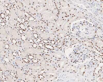 Immunohistochemistry-Paraffin: MSH2 Antibody (10G1) [NBP2-76895] - Immunohistochemical analysis of paraffin-embedded human kidney tissue using anti-MSH2 antibody. The section was pre-treated using heat mediated antigen retrieval with sodium citrate buffer (pH 6.0) for 20 minutes. The tissues were blocked in 5% BSA for 30