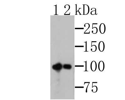 Western Blot: MSH2 Antibody (10G1) [NBP2-76895] - Western blot analysis of MSH2 on K562 cells lysates using anti-MSH2 antibody.Lane 1: Anti-MSH2 antibody, 1:500.Lane 2: Anti-MSH2 antibody, 1:5,000.