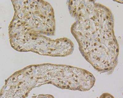 Immunohistochemistry: MSH2 Antibody (10G2) [NBP2-76896] - Immunohistochemical analysis of paraffin-embedded human kidney tissue using anti-MSH2 antibody. Counter stained with hematoxylin. The section was pre-treated using heat mediated antigen retrieval with sodium citrate buffer (pH6) for 20 mins.
