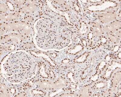 Immunohistochemistry-Paraffin: MSH2 Antibody (10G2) [NBP2-76896] - Immunohistochemical analysis of paraffin-embedded human kidney tissue using anti-MSH2 antibody. The section was pre-treated using heat mediated antigen retrieval with sodium citrate buffer (pH 6.0) for 20 minutes. The tissues were blocked in 5% BSA for 30