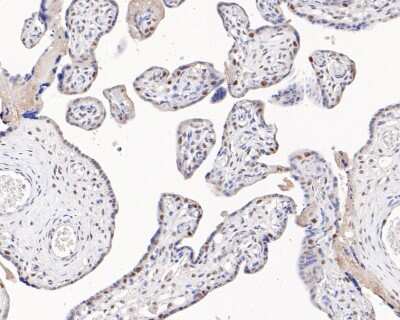 Immunohistochemistry-Paraffin: MSH2 Antibody (10G2) [NBP2-76896] - Immunohistochemical analysis of paraffin-embedded human placenta tissue using anti-MSH2 antibody. The section was pre-treated using heat mediated antigen retrieval with sodium citrate buffer (pH 6.0) for 20 minutes. The tissues were blocked in 5% BSA for