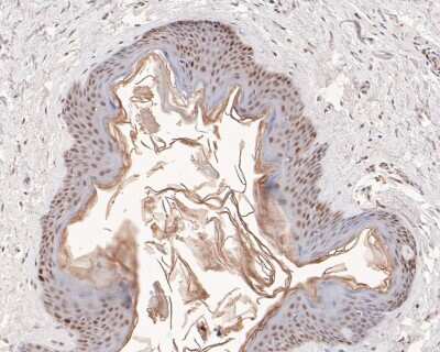 Immunohistochemistry-Paraffin: MSH2 Antibody (10G2) [NBP2-76896] - Immunohistochemical analysis of paraffin-embedded human skin tissue using anti-MSH2 antibody. The section was pre-treated using heat mediated antigen retrieval with sodium citrate buffer (pH 6.0) for 20 minutes. The tissues were blocked in 5% BSA for 30 m
