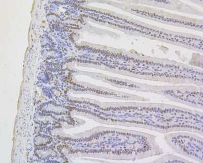 Immunohistochemistry-Paraffin: MSH2 Antibody (10G2) [NBP2-76896] - Immunohistochemical analysis of paraffin-embedded mouse colon tissue using anti-MSH2 antibody. The section was pre-treated using heat mediated antigen retrieval with sodium citrate buffer (pH 6.0) for 20 minutes. The tissues were blocked in 5% BSA for 30